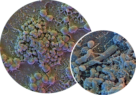 2 images graphiques côte à côte du biofilm de la plaque dentaire