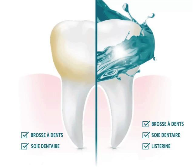 Image graphique d'une dent montrant le résultat de l'emploi du rince-bouche, de la brosse à dents et de la soie dentraire sur une moitié de la dent par rapport à l'emploi de la brosse à dents et de la soie dentaire seules sur l'autre moitié de la dent. 
